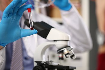 Eine Hand mit blauem Handschuh hält vor einem Mikroskop eine Blutprobe hoch